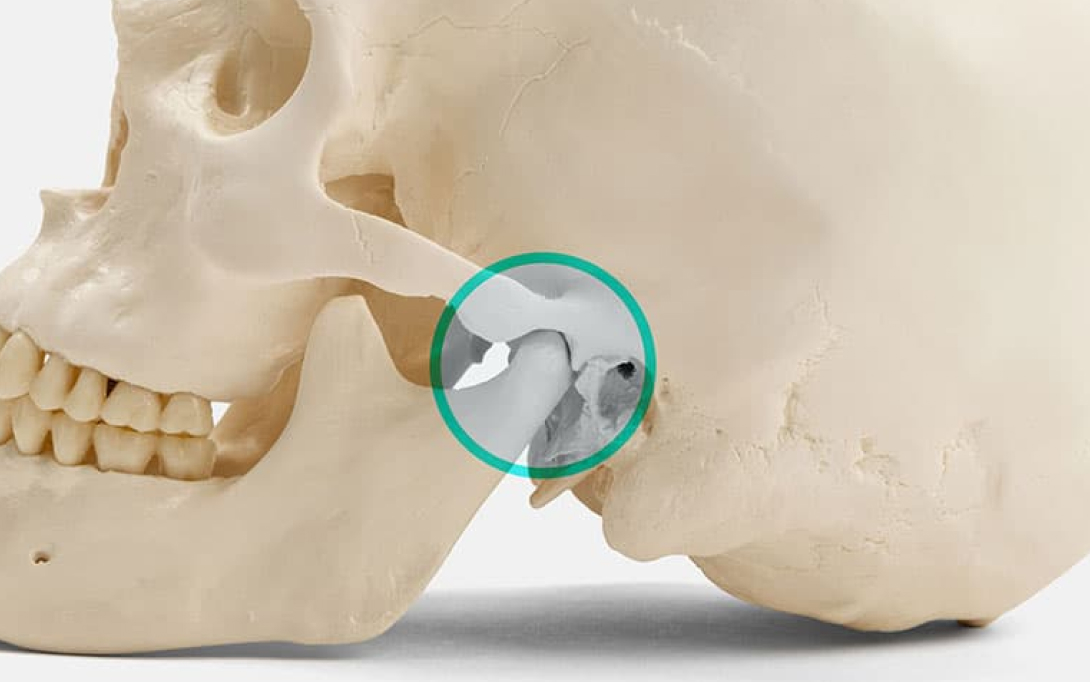 close up of jawbone model