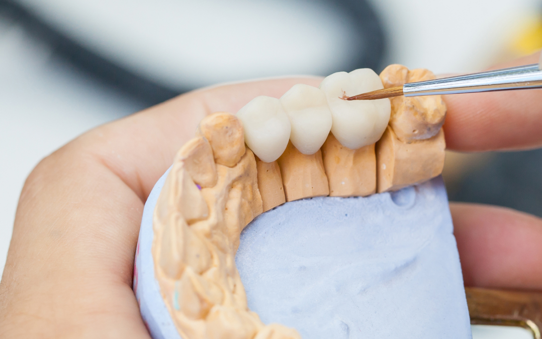 dentist holding model of dental bridge